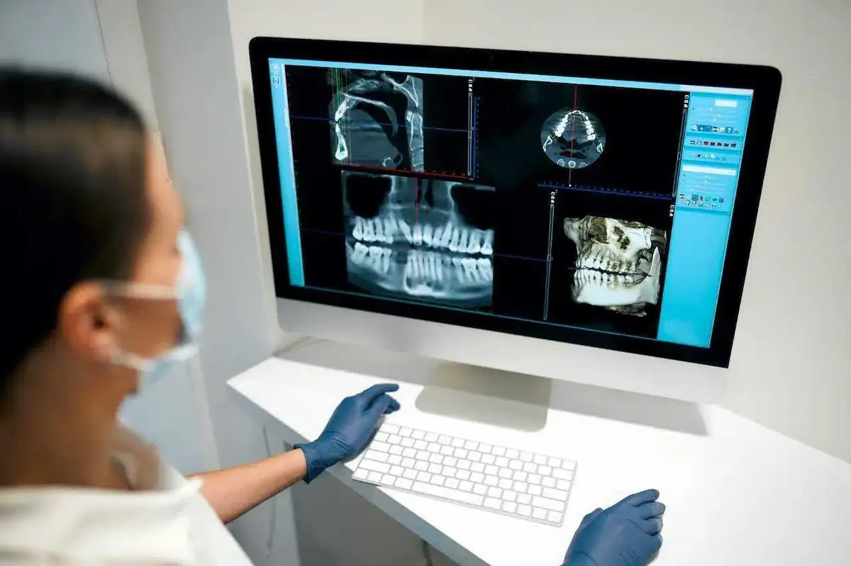 Pianificazione implantare su TAC 3D